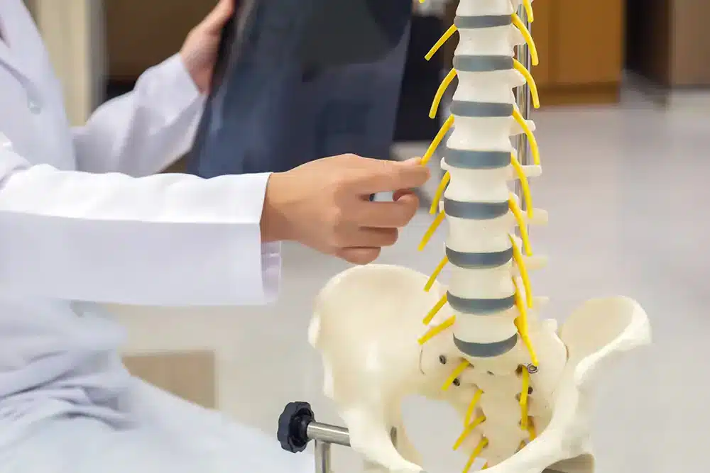 آرتروز ستون فقرات آرتروز ستون فقرات