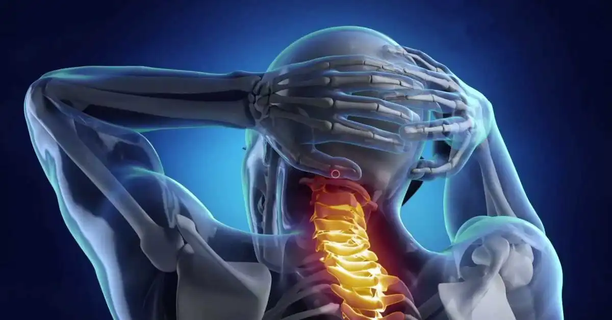 درمان آرتروز ستون فقرات درمان آرتروز ستون فقرات