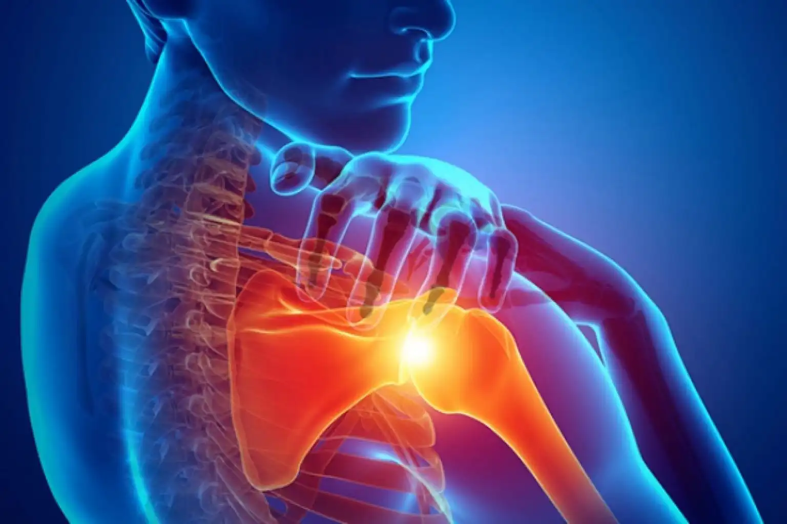 آرتروز مفصل شانه آرتروز مفصل شانه