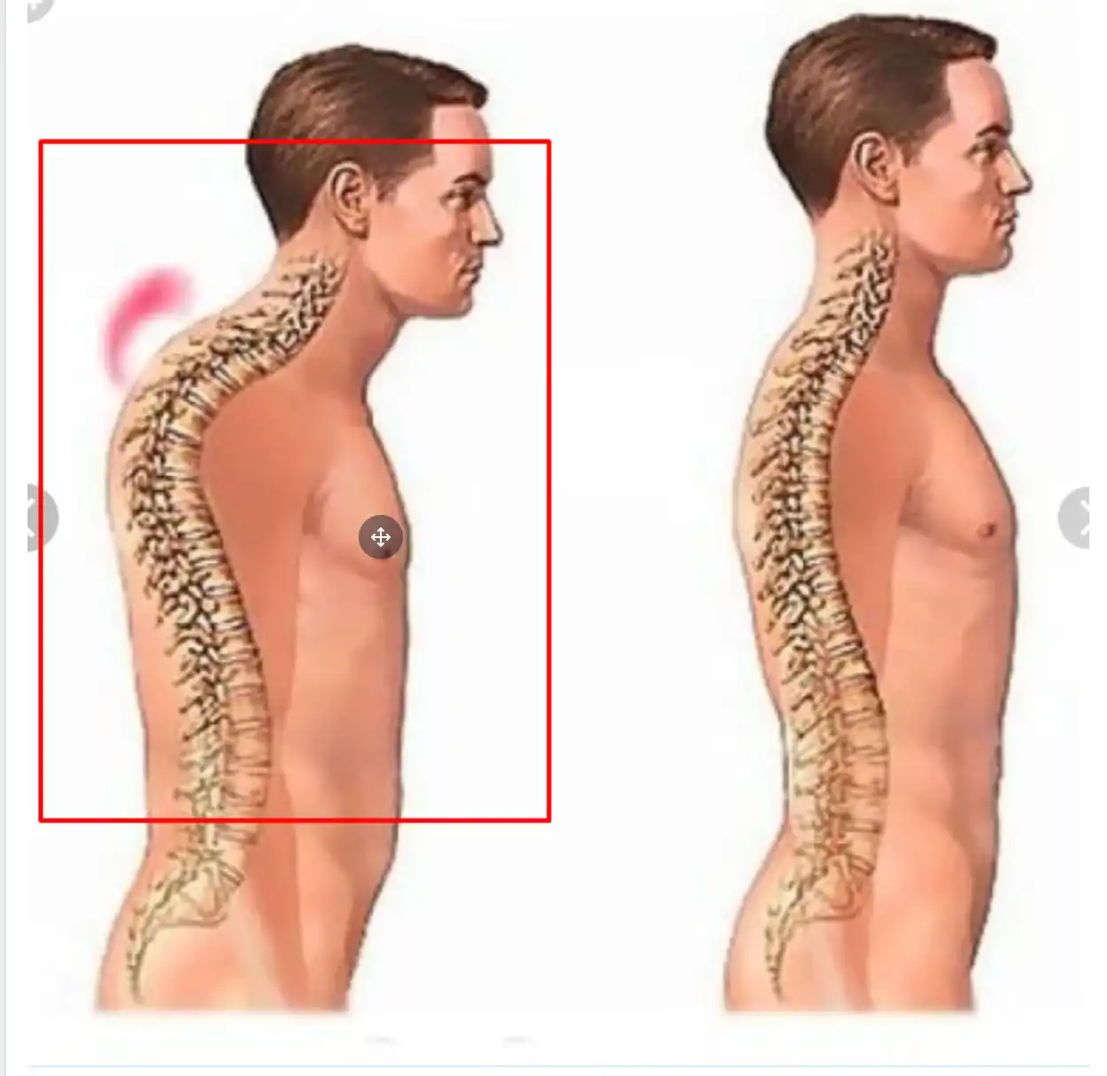 حالت طبیعی ستون فقرات حالت طبیعی ستون فقرات