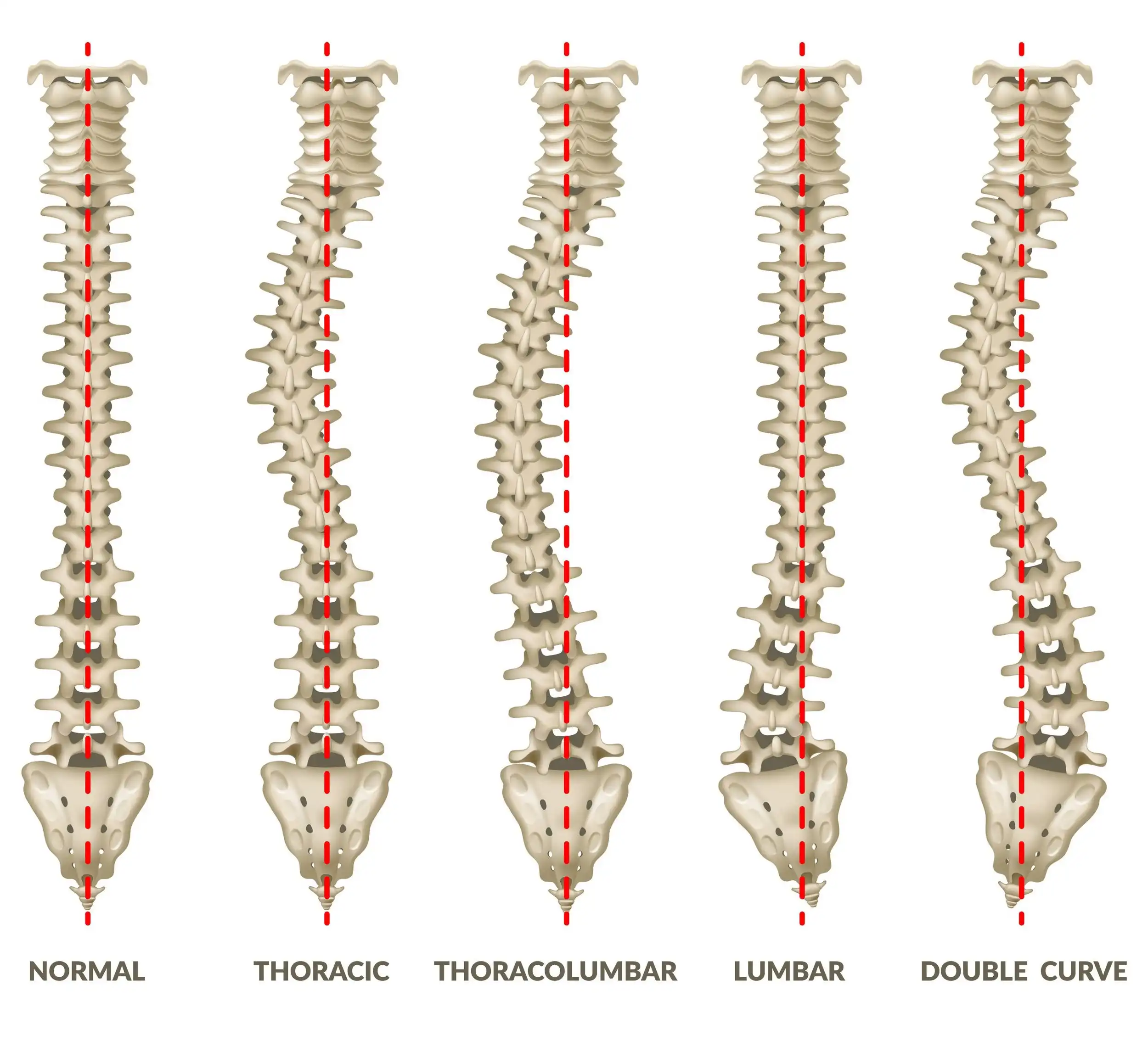 حالت طبیعی ستون فقرات حالت طبیعی ستون فقرات