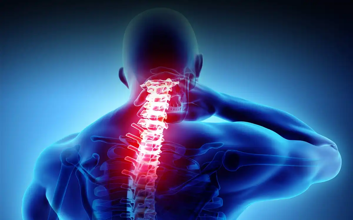 آرتروز ستون فقرات آرتروز ستون فقرات