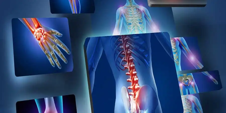 قرص درمان درد مفصل شانه قرص درمان درد مفصل شانه