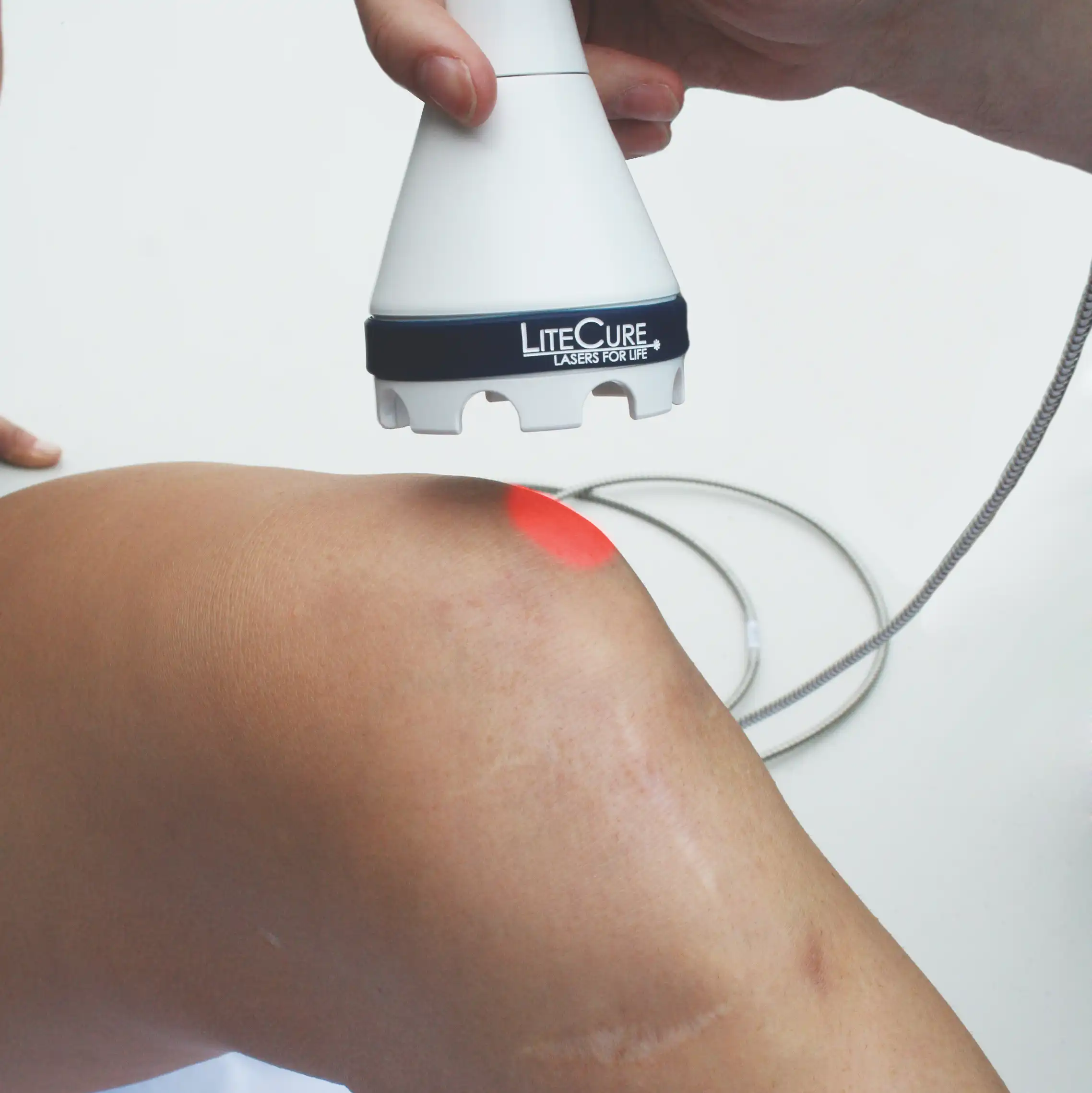 لیزر درمانی زانو چیست لیزر درمانی زانو