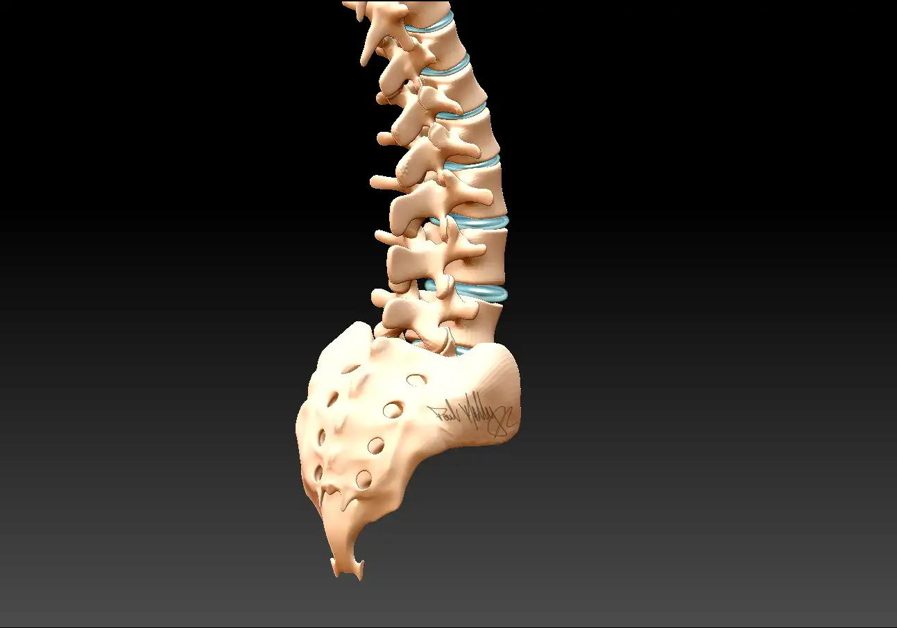 روماتیسم ستون فقرات روماتیسم ستون فقرات