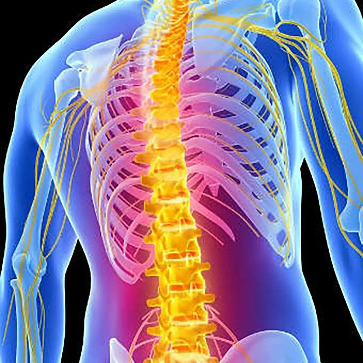روماتیسم ستون فقرات و درمان روماتیسم ستون فقرات و درمان