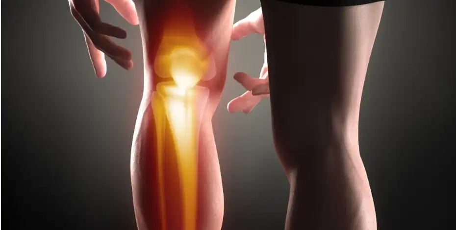 معافیت پزشکی پارگی رباط صلیبی معافیت پزشکی پارگی رباط صلیبی