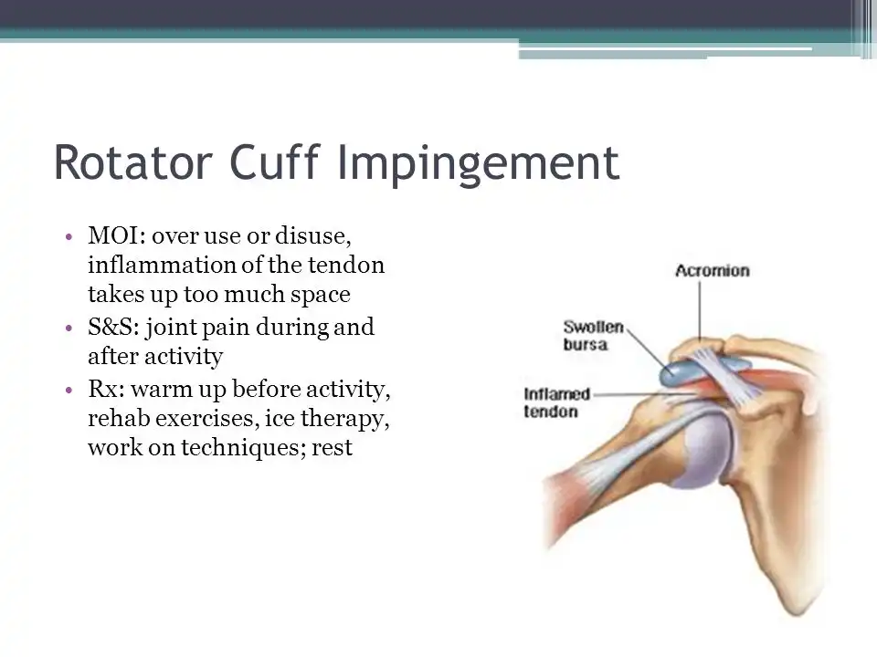 درد مفصل شانه درد مفصل شانه