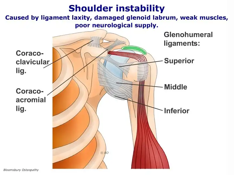بی ثباتی مفصل شانه بی ثباتی مفصل شانه