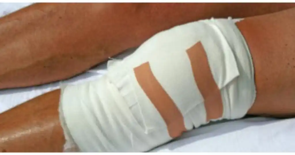 نحوه خوابیدن بعد از تعویض مفصل زانو نحوه خوابیدن بعد از تعویض مفصل زانو