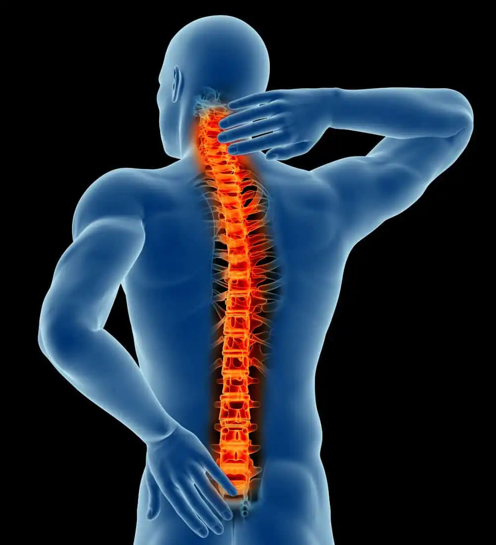بیماری های ستون فقرات بیماری های ستون فقرات