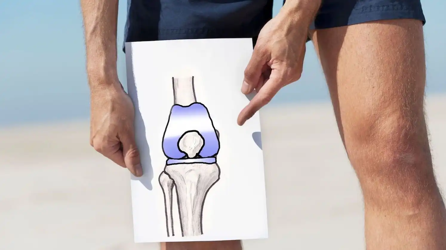 فیلم عمل تعویض مفصل زانو