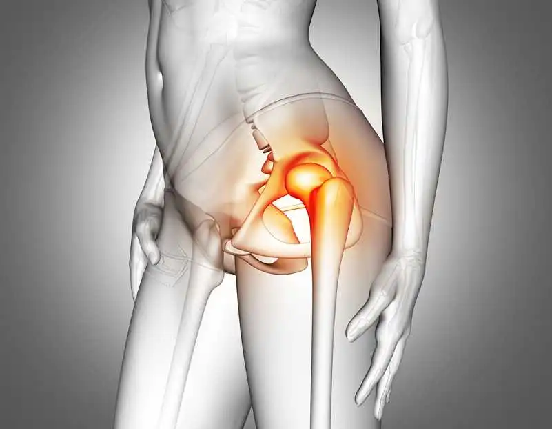 فیلم تعویض مفصل ران لگن