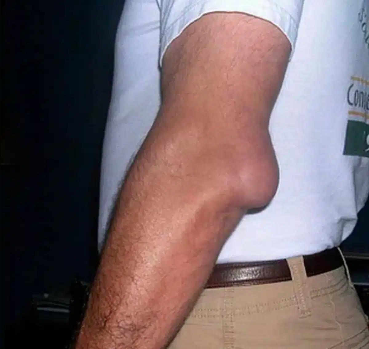 بوریست اولکرانون