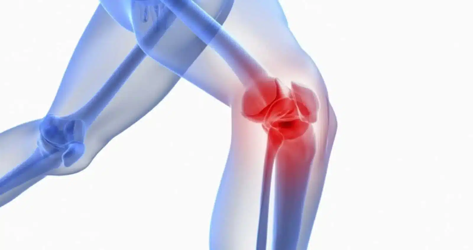 آرتریت پا چیست Arthritis of the foot