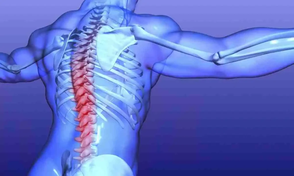 بیماری های ستون فقرات