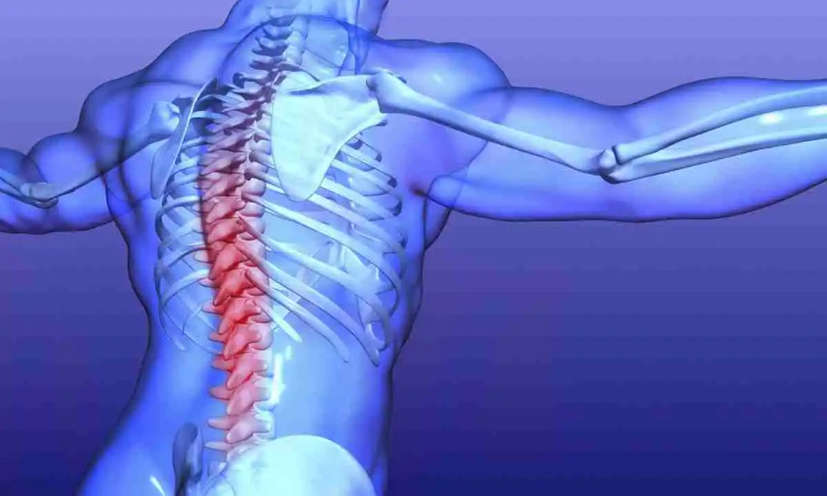 بیماری های ستون فقرات