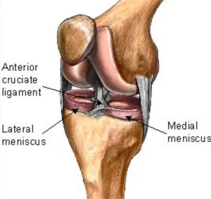 پارگی رباط صلیبی خلفی قدامی پارگی رباط صلیبی خلفی قدامی