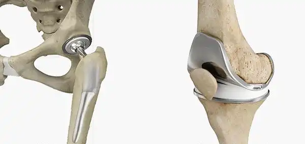 ابزار جراحی تعویض مفصل زانو Knee joint replacement surgery tool