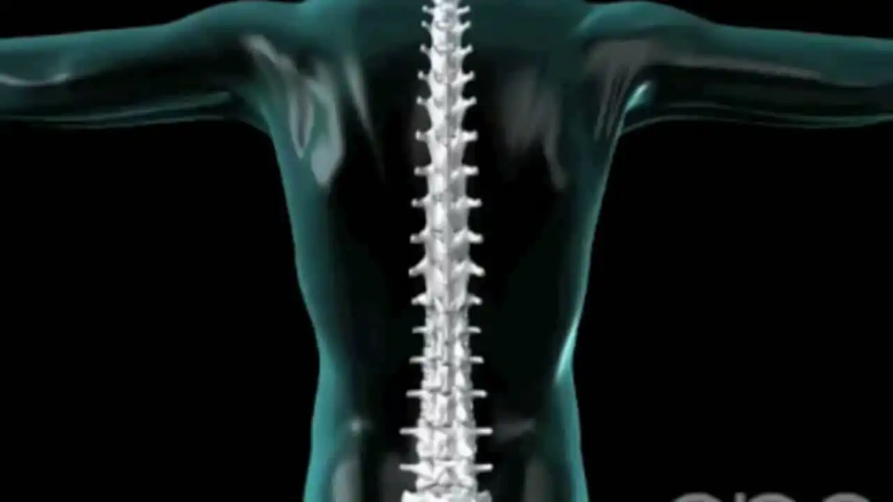 علت انحراف ستون فقرات