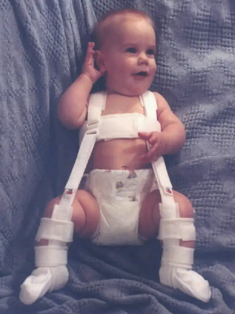 درد مفصل زانو در کودکان