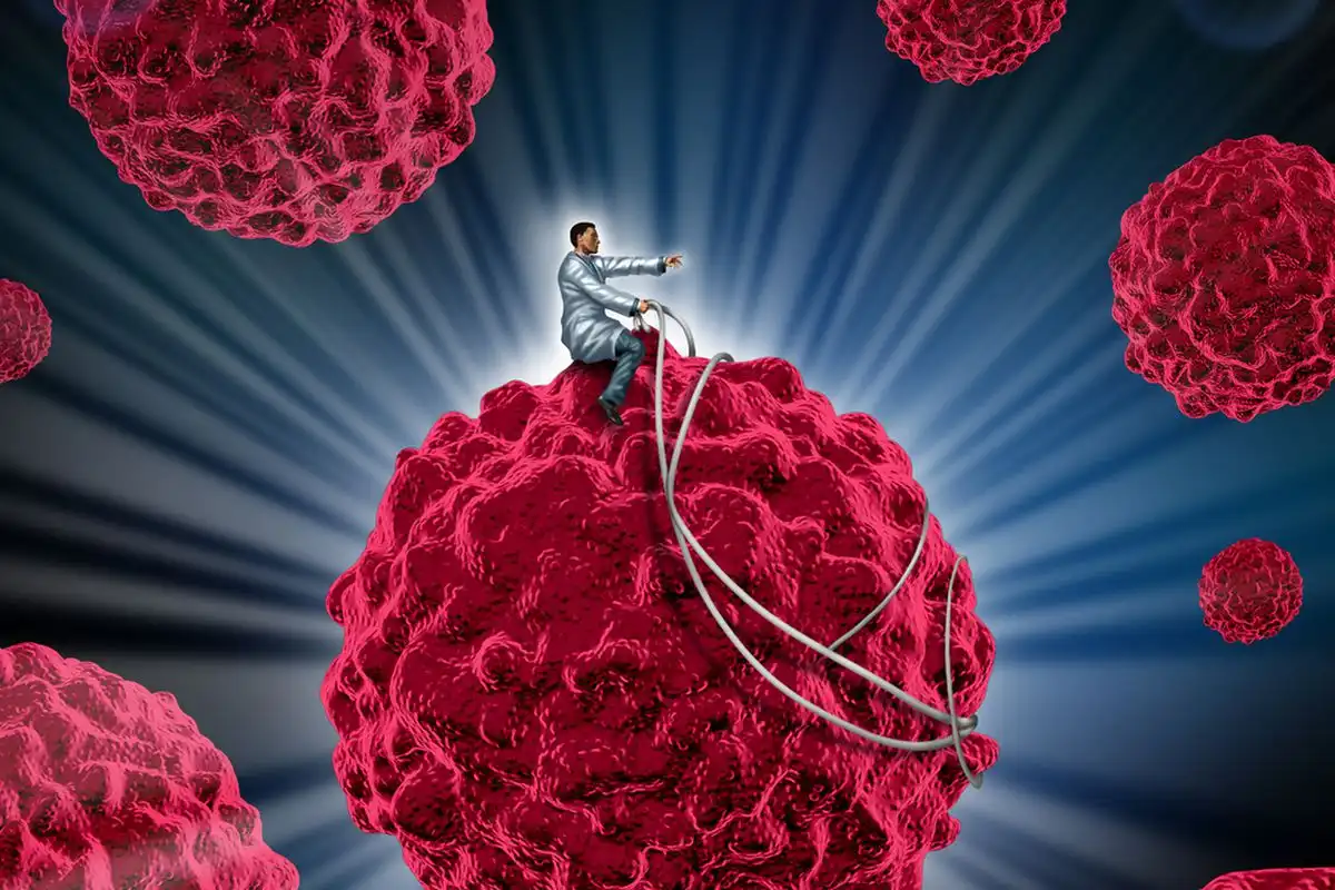 علائم سرطان مفصل لگن علائم سرطان مفصل لگن