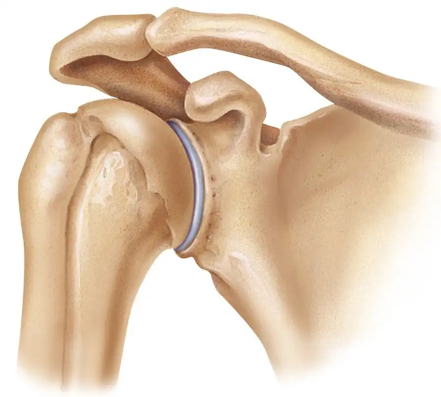 علت صدای مفصل شانه