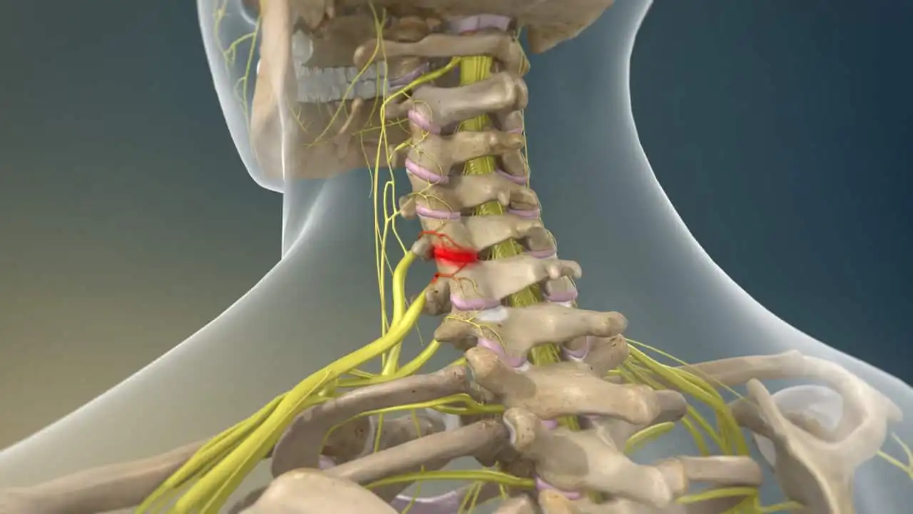 درد ستون فقرات گردن درد ستون فقرات گردن