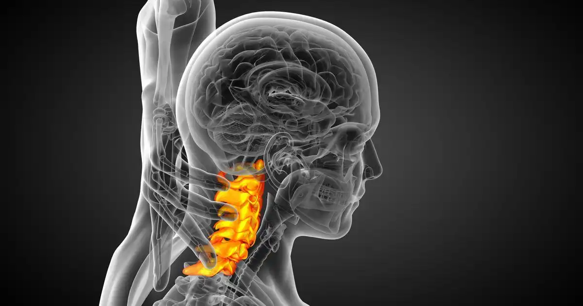 سرطان ستون فقرات