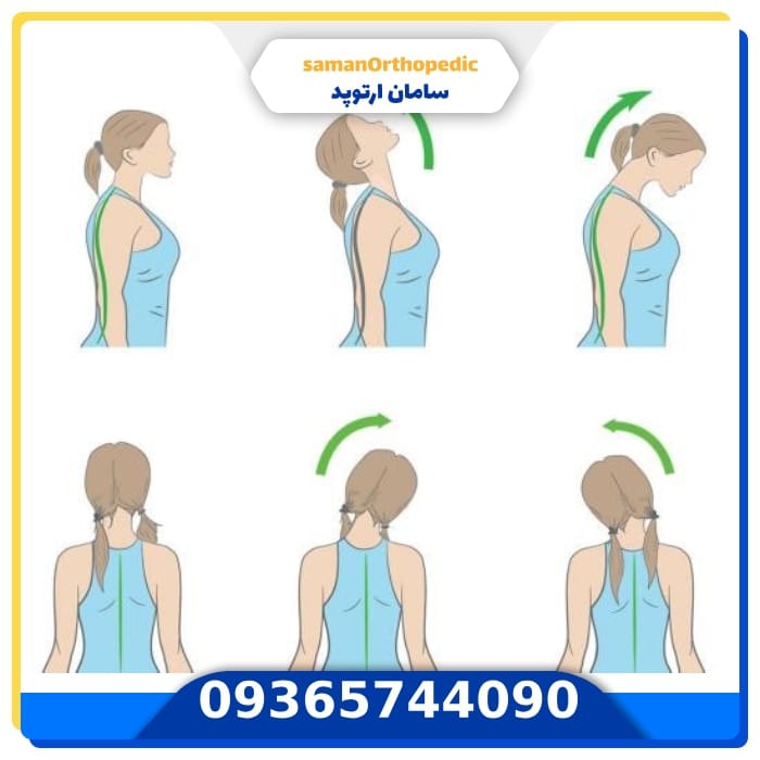 عمل ستون فقرات گردن