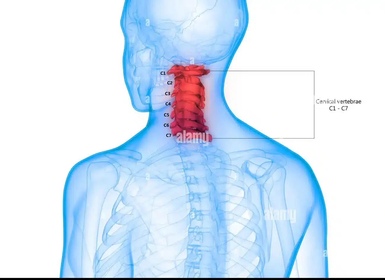 تغییرات دژنراتیو ستون فقرات تغییرات دژنراتیو ستون فقرات