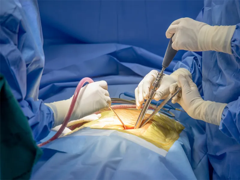 چه موقع دیسک کمر احتیاج به عمل دارد؟ عمل دیسک کمر