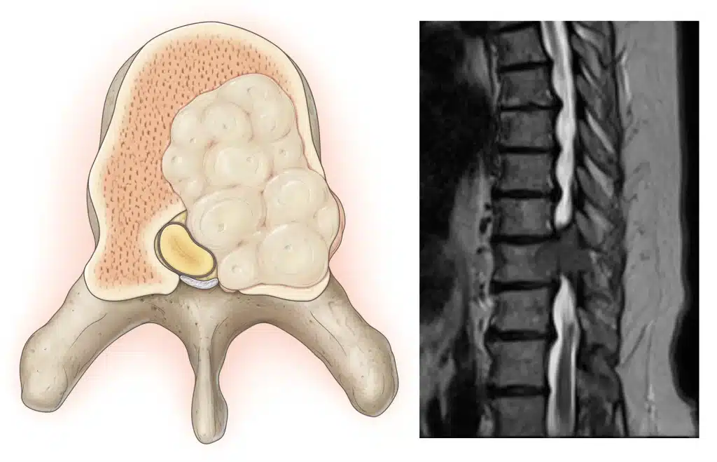راستای ستون فقرات راستای ستون فقرات