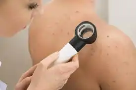 جوش چرکی روی ستون فقرات