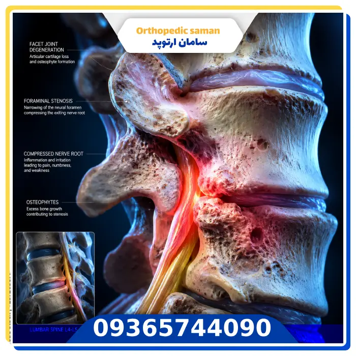 علائم تغییرات دژنراتیو ستون فقرات چیست؟