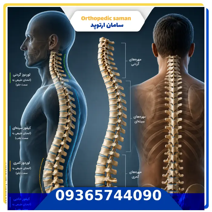 حالت طبیعی ستون فقرات چه شکلی است؟