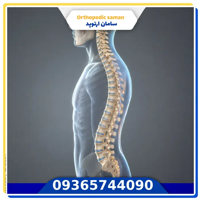 تفاوت قوس طبیعی ستون فقرات با انحراف چیست؟
