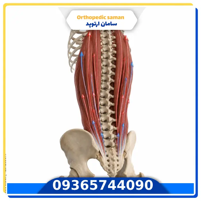 نقش عضلات راست کننده در صاف نگه داشتن بدن