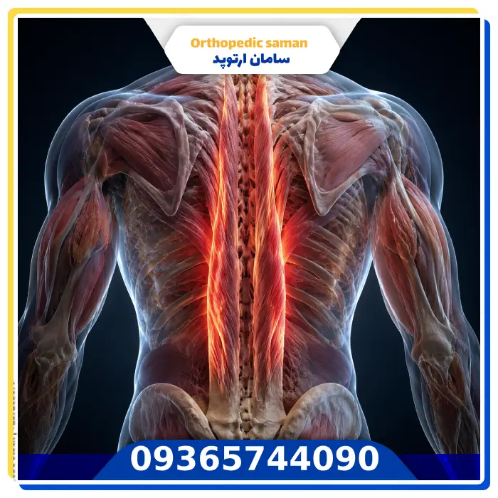 آیا ضعف عضلات باعث تغییر وضعیت بدن می‌شود؟