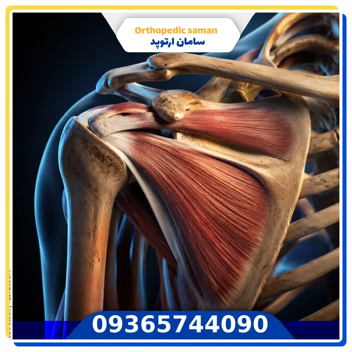 نام عضلات مفصل شانه چیست؟ معرفی عضلات و وظیفه هرکدام عضلات شانه چگونه باعث حرکت و پایداری مفصل میشوند؟