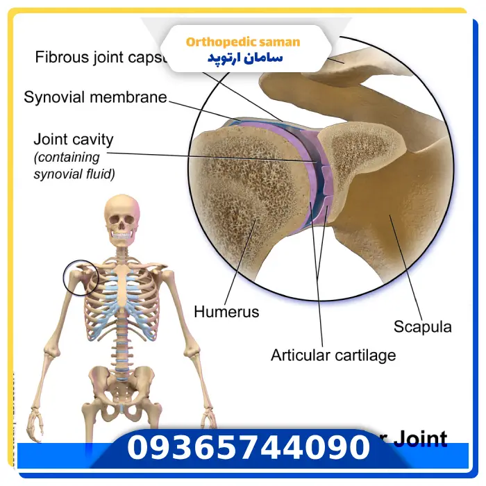 مسیر تشخیص دقیق ریشه صداهای شانه در معاینه ارتوپدی