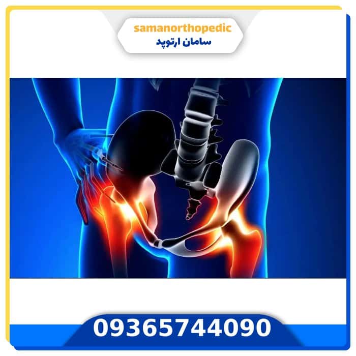 درمان صدا دادن مفصل لگن