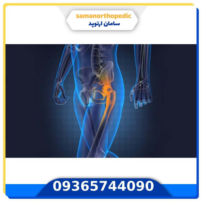 درمان صدا دادن مفصل لگن