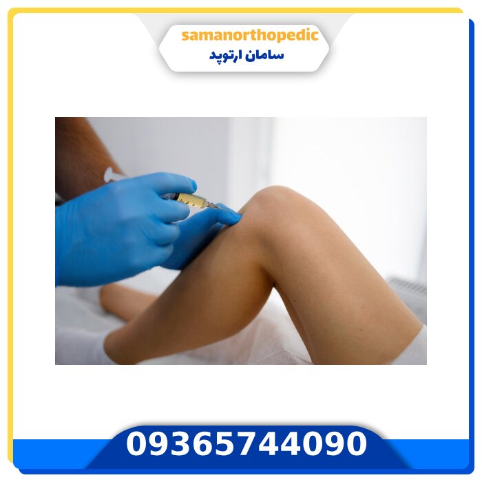 پی آر پی زانو چیست؟