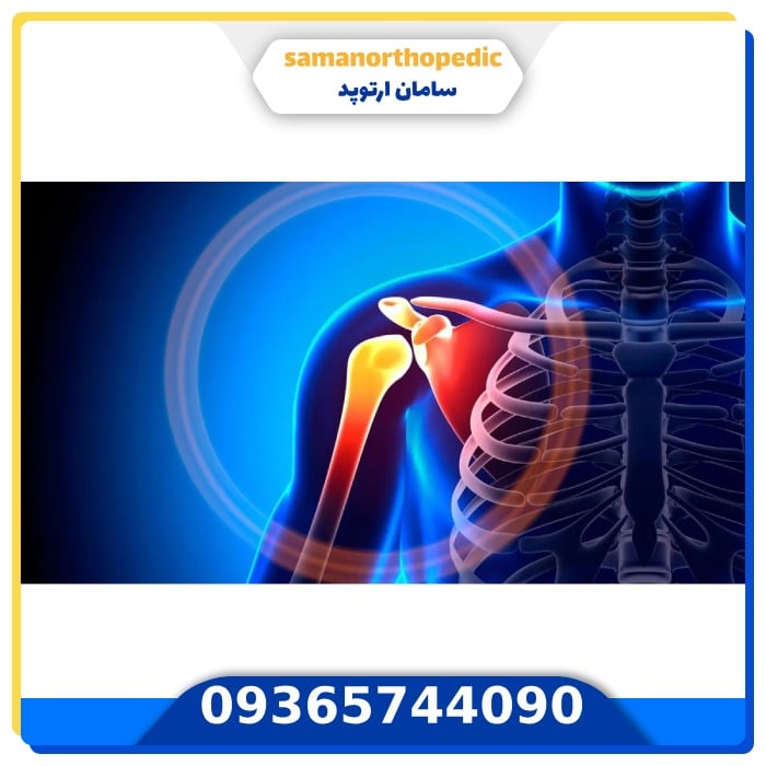 درمان التهاب مفصل شانه