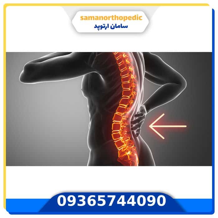 حرکات اصلاحی چیست