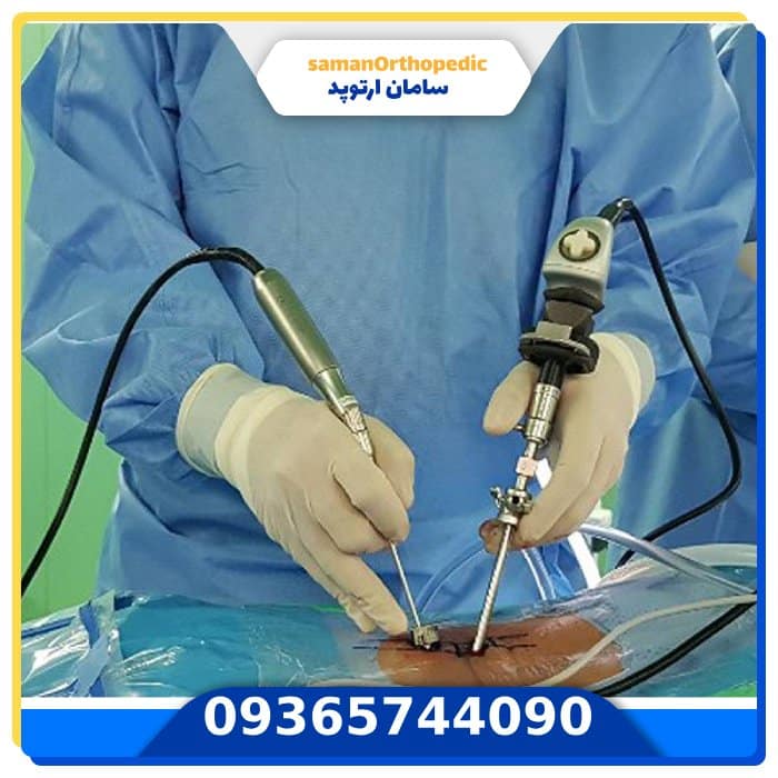 معرفی روش های عمل دیسک کمر