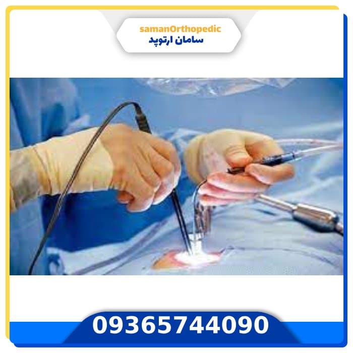 معرفی انواع روش های عمل دیسک کمر