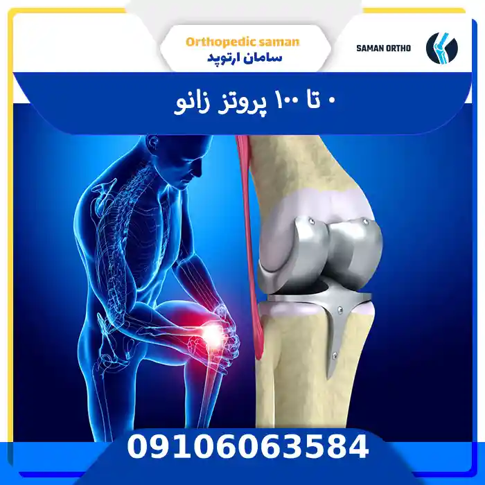 پروتز زانو
