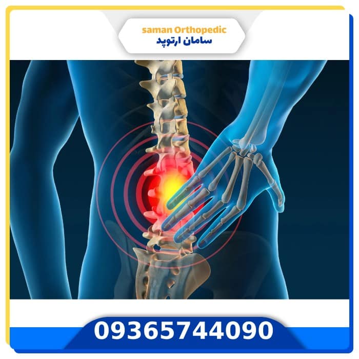 سامان ارتوپد با شماست تا عمل جراحی دیسک کمر